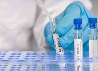 Doctor's hand in blue gloves Working with test tubes at virus analysis in a medical lab; Picture Source; MHA