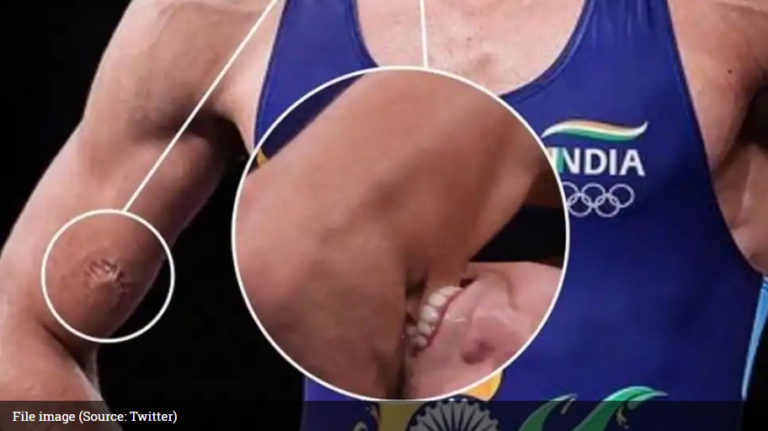 Wrestler Ravi Dahiya bitten by opponent in semi-final wins Silver Medal