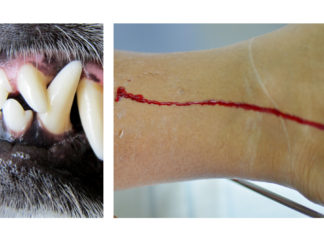 2-year-old child dies after dog attack