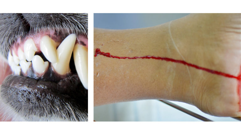 2-year-old child dies after dog attack