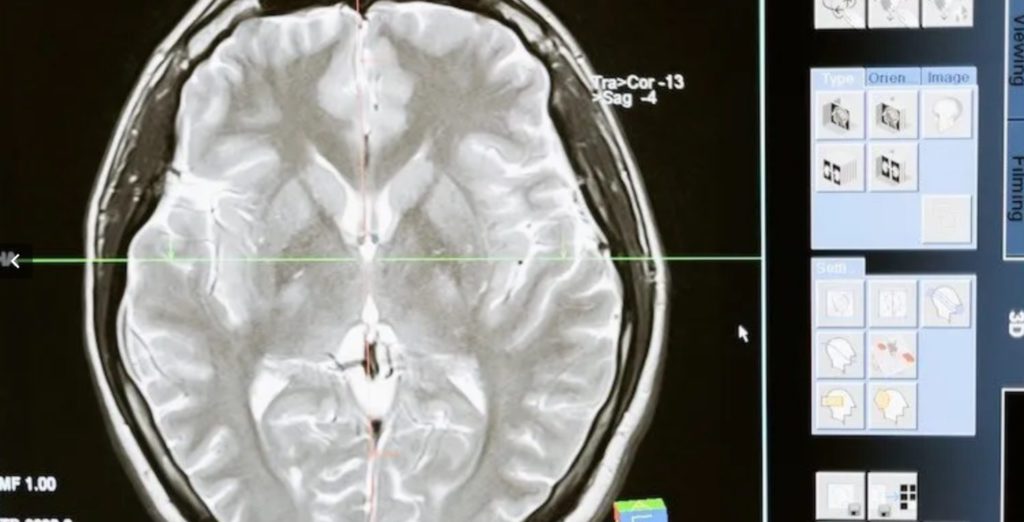 Web capture 8 12 2022 20140 www.globalhealthneurolab.org 1