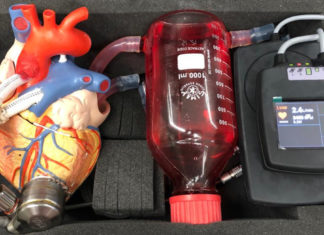 Aussie company with Indian investors creating device to assist with end stage heart failure