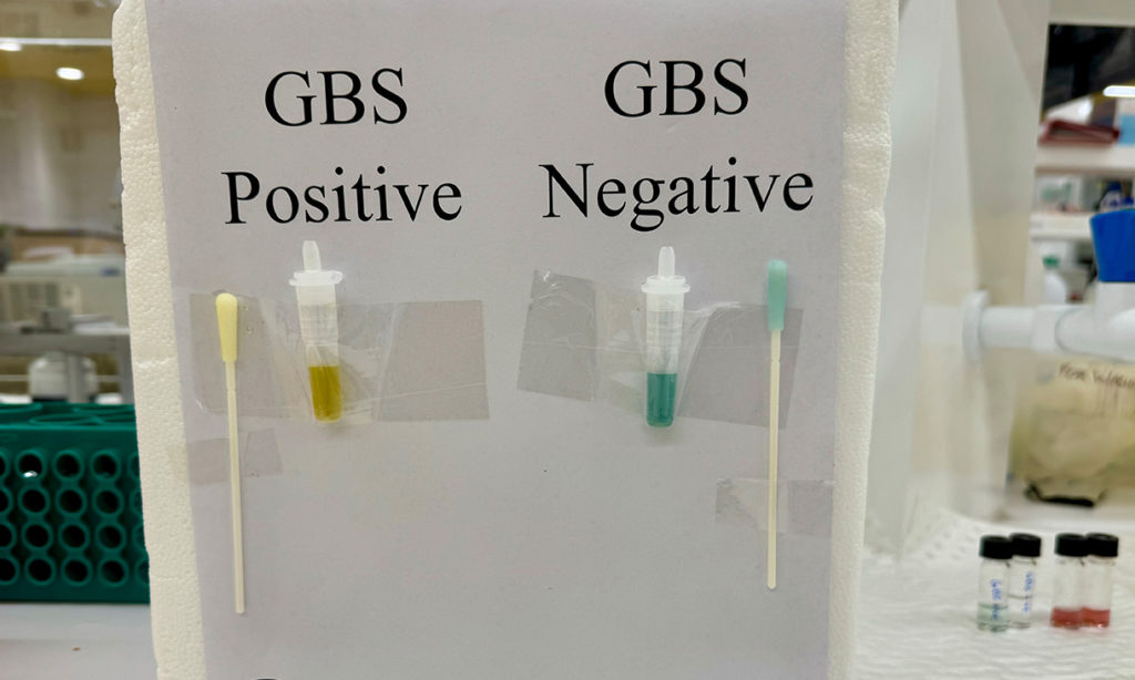 news GBS positive negative 1220px 1