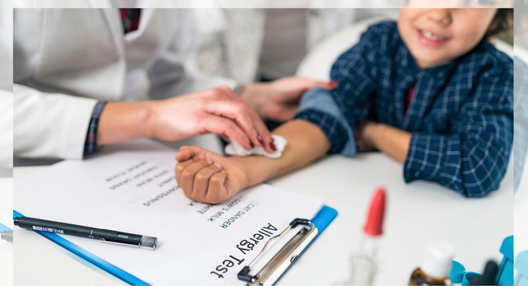 Representative image: Food allergy test (Source: CANVA)