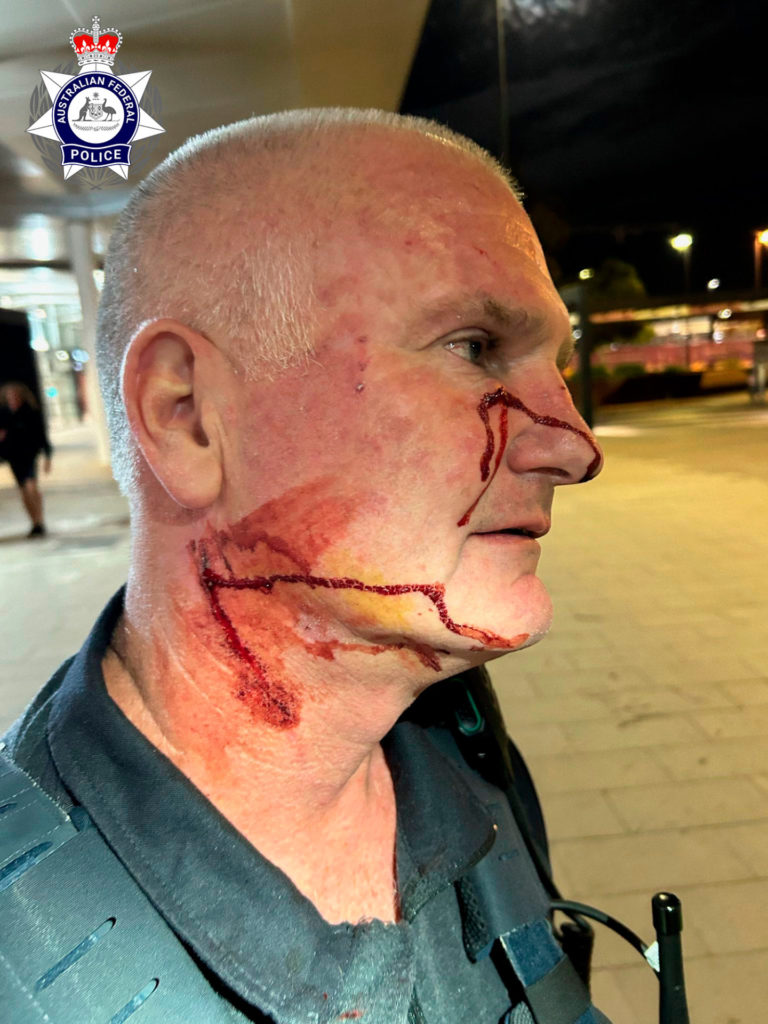 injured AFP officer 2 Badged 3