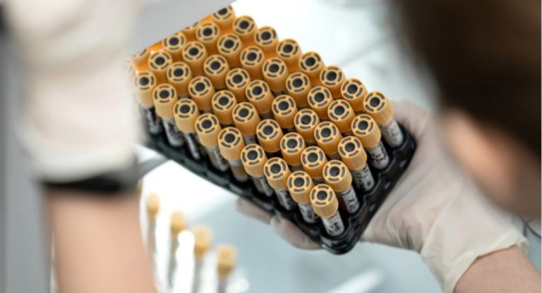 National biobanking platform could deliver $39 million in annual benefits, says CSIRO