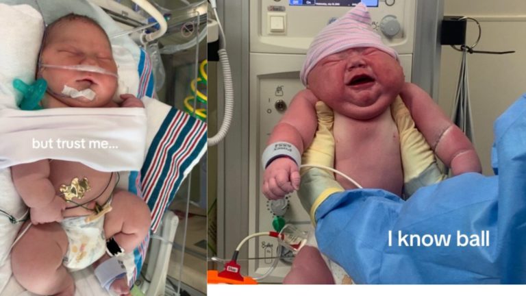 News of a ‘giant’ baby boy is all over TikTok. Here’s what women really need to know