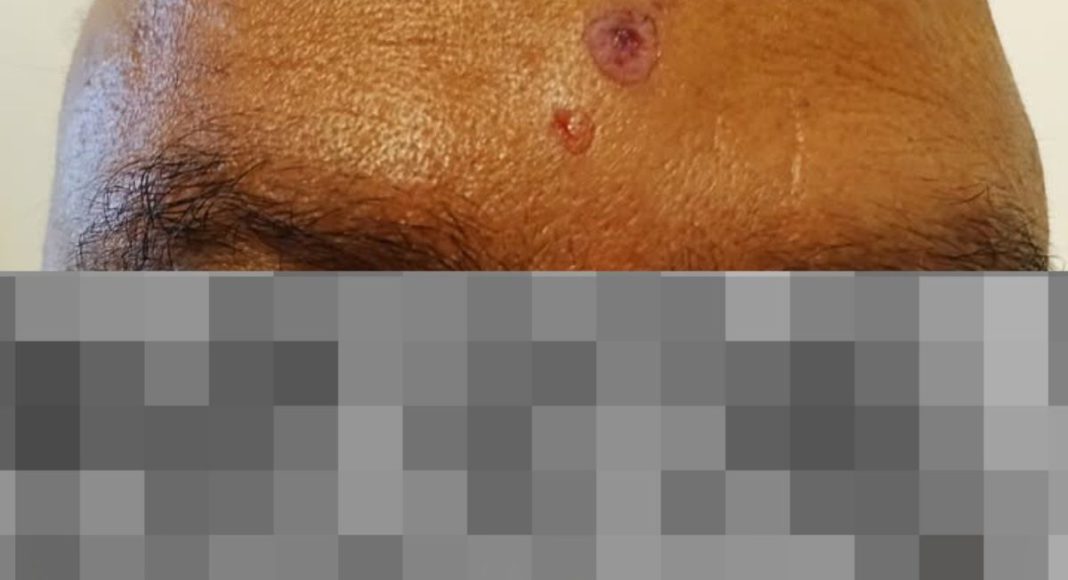 Image: Racial attack on an Indian-Australian man (Source: Facebook)