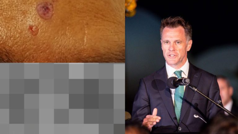 ‘Racism has no place here’: Premier Minns, MPs speak out after alleged assault on Indian-Australian community leader