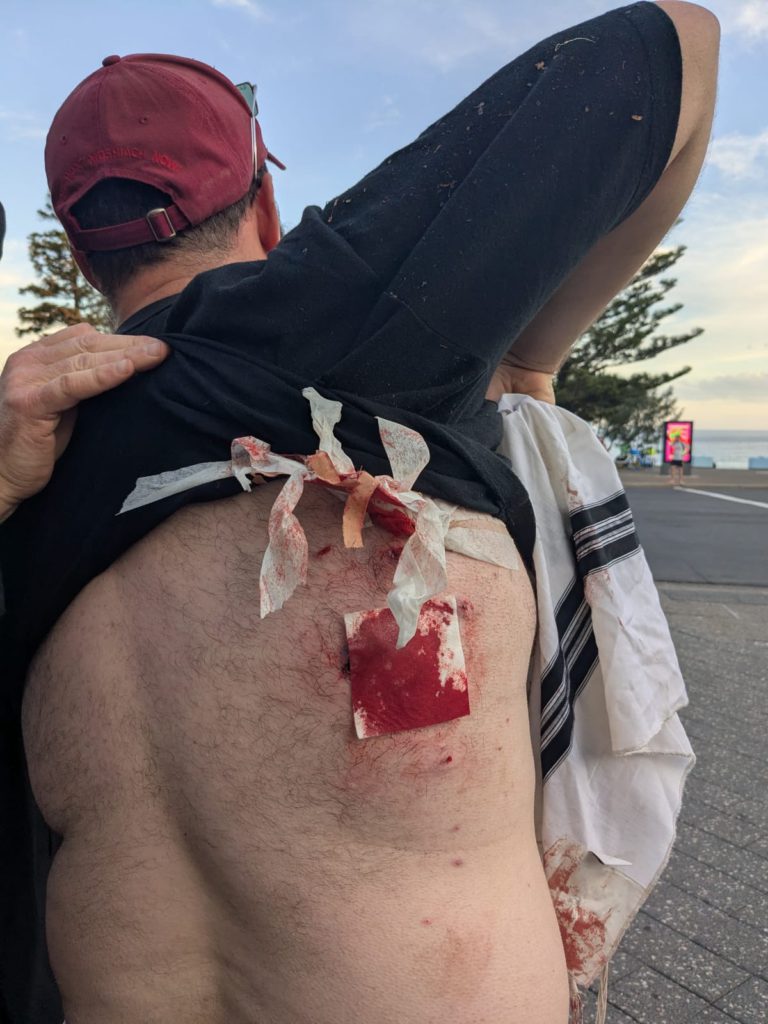Bondi Beach locked down as police arrest two after reported gunfire 1 G8HdYbLaAAAKzVr 1