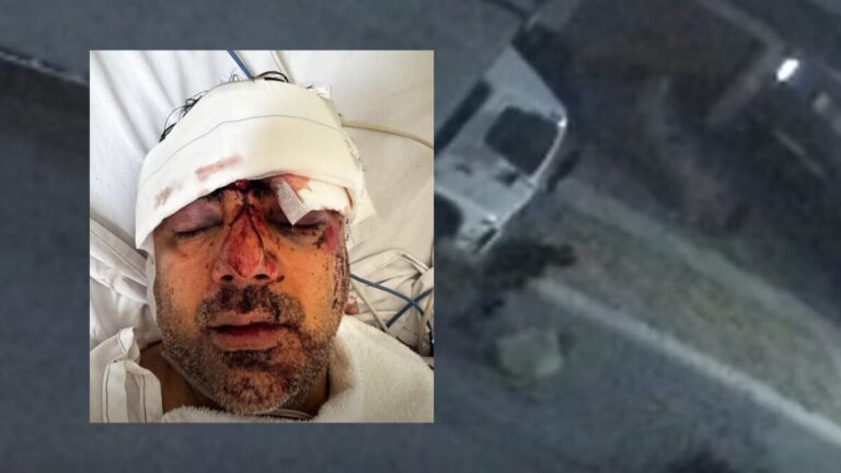 Melbourne truck driver Supinder Pal Singh hospitalised after vicious targeted attack outside home