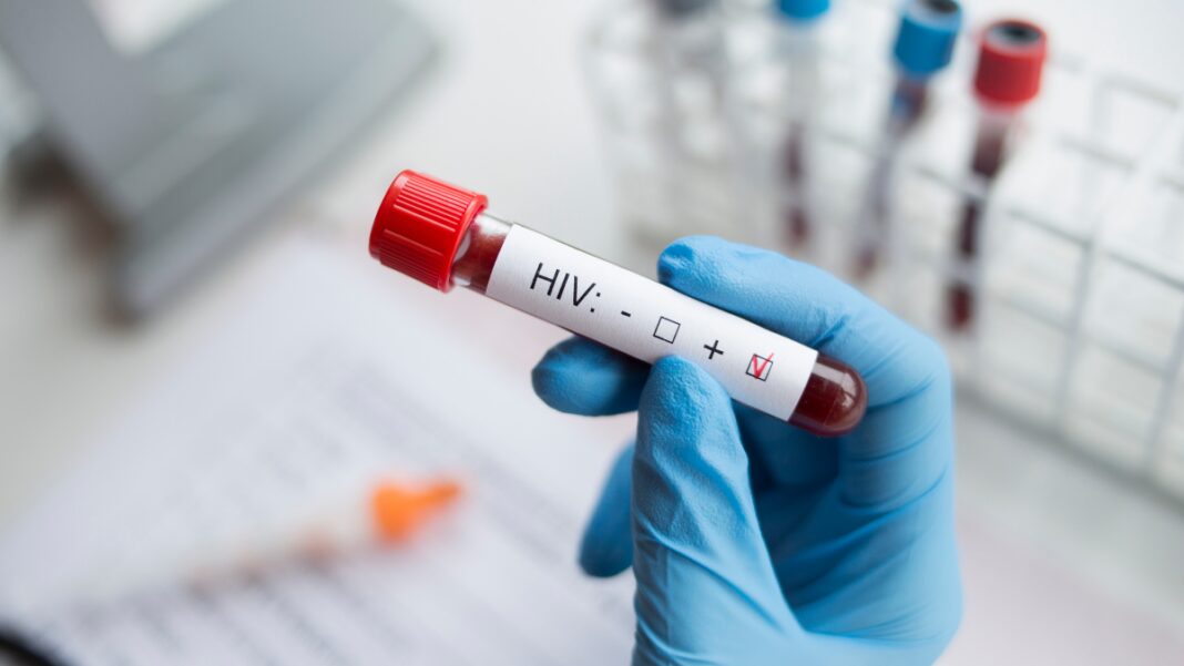 Representative image: HIV testing (Source: CANVA)